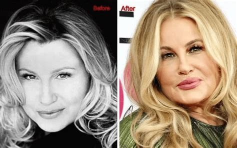 jennifer coolidge before plastic surgery|Truth Behind Jennifer Coolidge’s Plastic Surgery Rumors